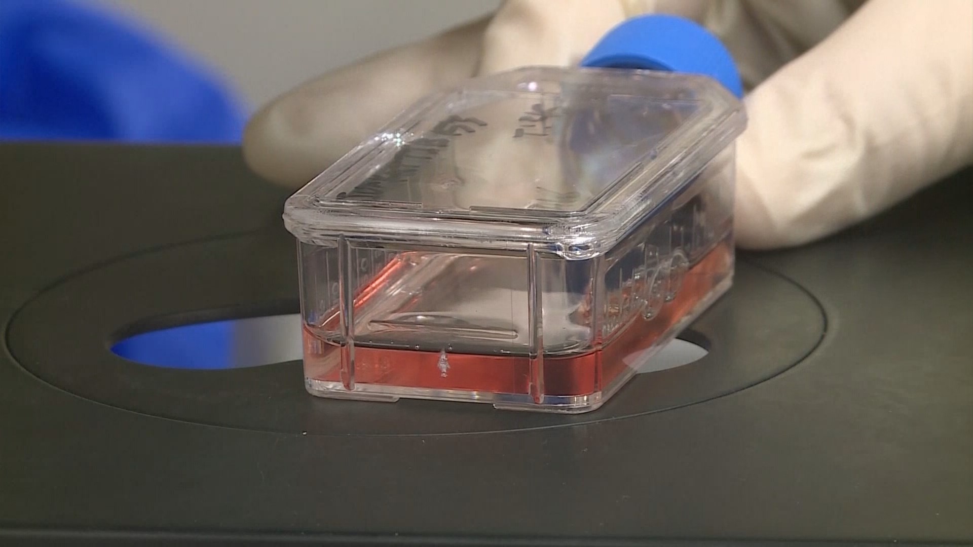 New technique to preserve donated organs